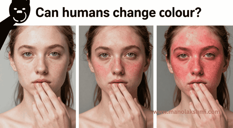 Can humans change colour?